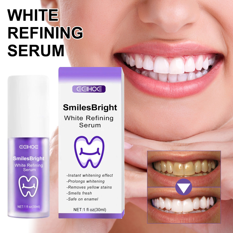 Teeth Whitening In Korea - ยาสีฟันทำความสะอาดฟัน ฟอกสีฟัน เจลฟอกสีฟัน ขจัดคราบ ลมหายใจหอมสดชื่น ผลิตภัณฑ์ทำความสะอาดฟันจากเกาหลี