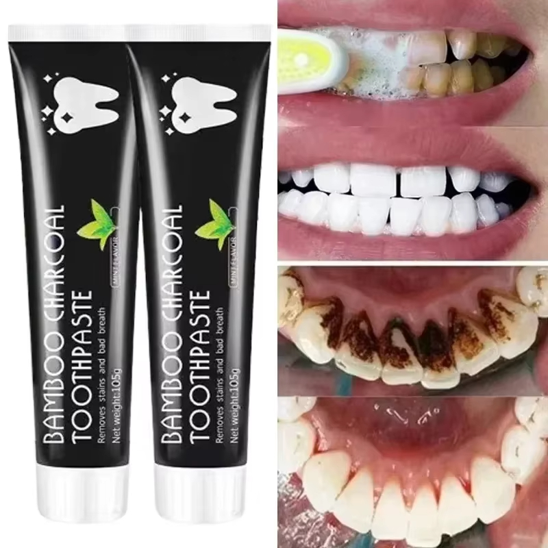 Teeth Whitening Charcoal - ยาสีฟันไวท์เทนนิ่ง ยาสีฟันถ่านไม้ไผ่ ดูดซับกลิ่นปาก ขจัดคราบเหลืองบนฟัน ทำความสะอาดคราบฟันอย่างเข้มข้น ดูแลสุขภาพช่องปาก