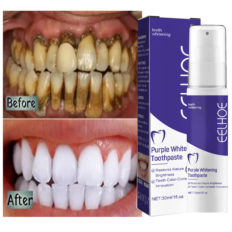 Teeth Whitening In Korea - 1ชิ้นยาสีฟันสูตรฟันขาวทำความสะอาดฟันขาวเจลฟอกสีฟันขจัดคราบลมหายใจสดชื่นทำความสะอาดฟันผลิตภัณฑ์เกาหลี