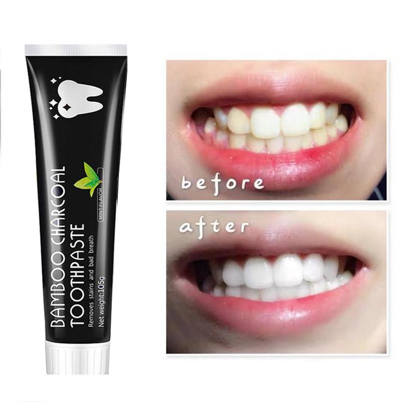 Teeth Whitening Charcoal - ยาสีฟันไวท์เทนนิ่งผสมถ่านกัมมันต์ กลิ่นมิ้นท์ ยาสีฟันธรรมชาติ ทำความสะอาดคราบฟันอย่างล้ำลึก ดูแลสุขภาพช่องปาก ยาสีฟันถ่านไม้ไผ่