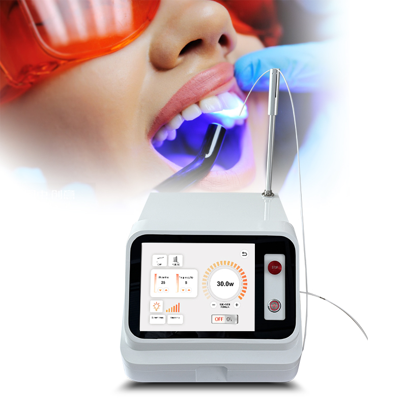 เครื่องเลเซอร์สำหรับเนื้อเยื่อ - Teeth Whitening With Laser บทวิจารณ์และราคา