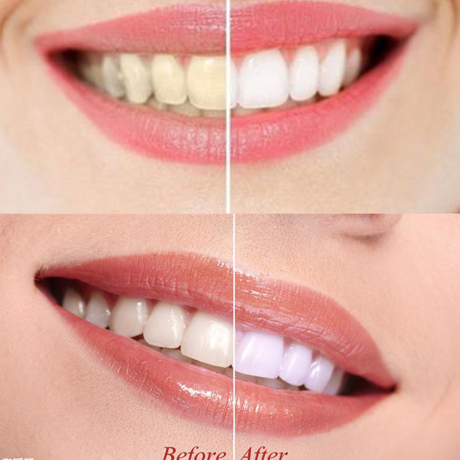 ถ่านไม้ไผ่ฟันฟันทันตกรรมสูตร L - Teeth Whitening Charcoal บทวิจารณ์และราคา