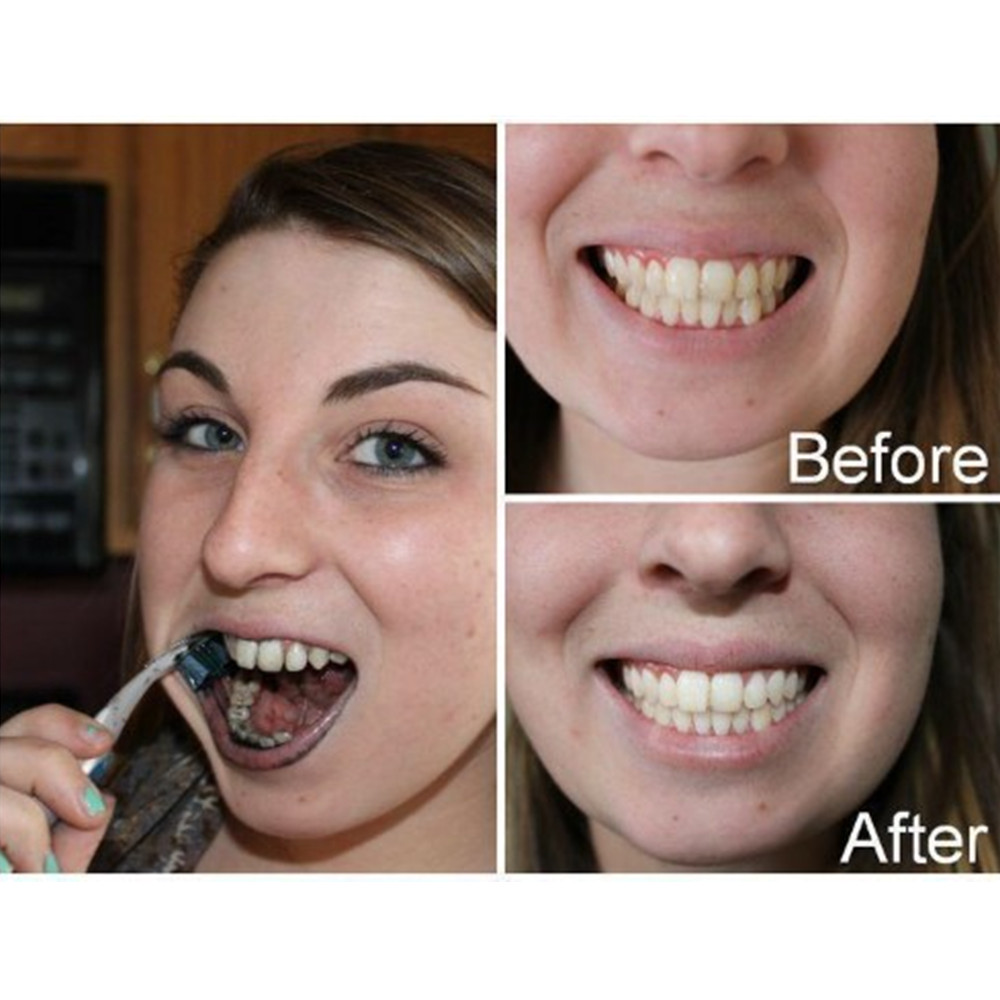 ถ่านไม้ไผ่ฟันฟันทันตกรรมสูตร L - Teeth Whitening Charcoal บทวิจารณ์และราคา