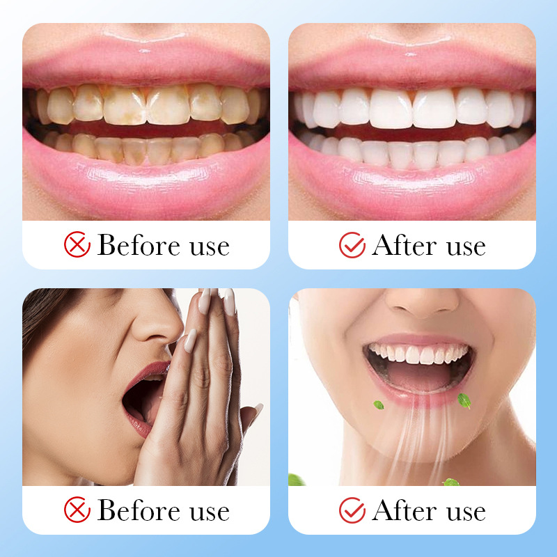 ถ่านไม้ไผ่ ถ่านกัมมันต์ ผงฟอกส - Teeth Whitening Charcoal บทวิจารณ์และราคา