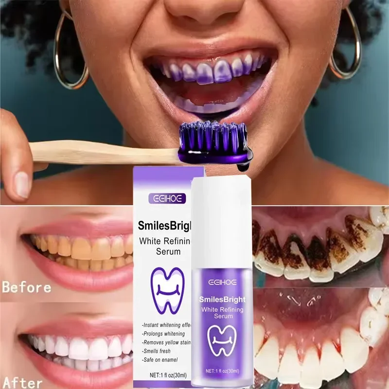 ยาสีฟันทำความสะอาดฟัน ฟอกสีฟัน - Teeth Whitening In Korea บทวิจารณ์และราคา