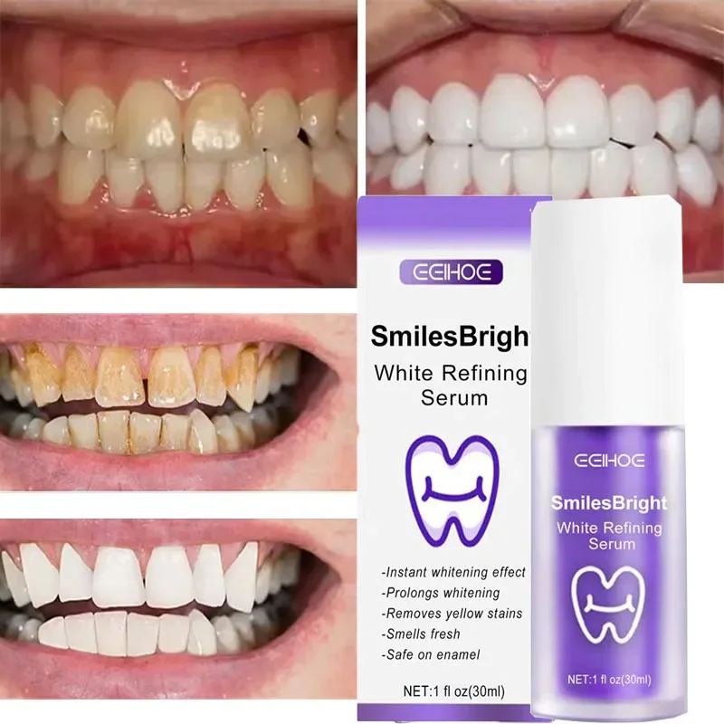 ยาสีฟันทำความสะอาดฟัน ฟอกสีฟัน - Teeth Whitening In Korea บทวิจารณ์และราคา