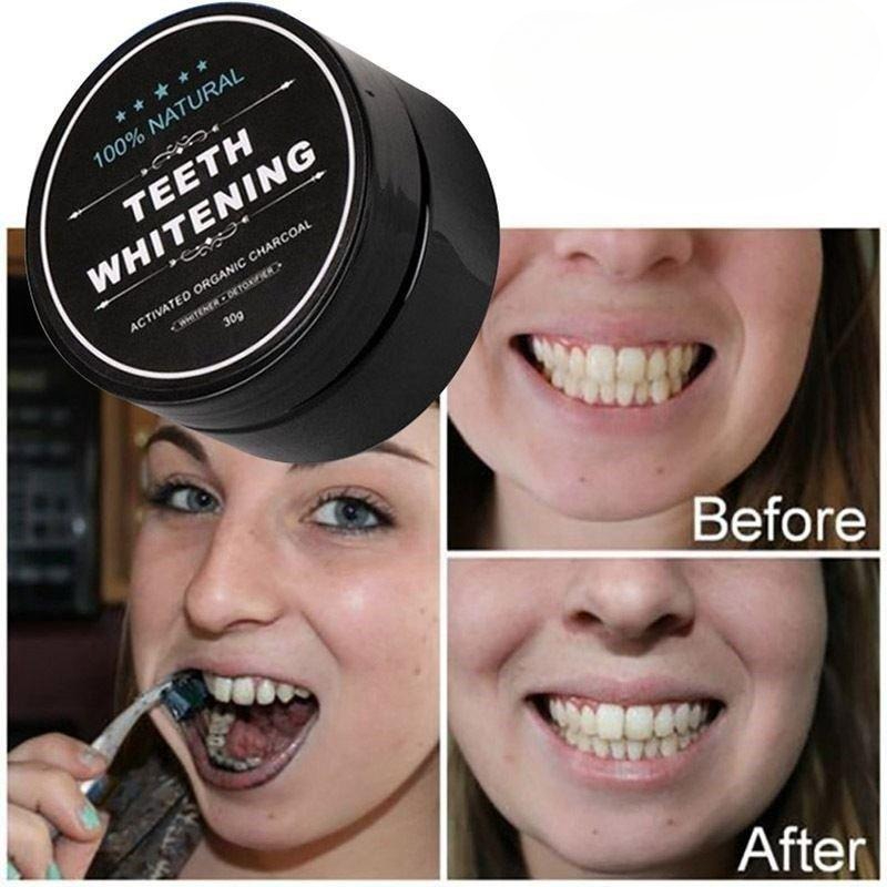 ผงฟอกสีฟันถ่านกัมมันต์ 1 กล่อง - Teeth Whitening Charcoal บทวิจารณ์และราคา