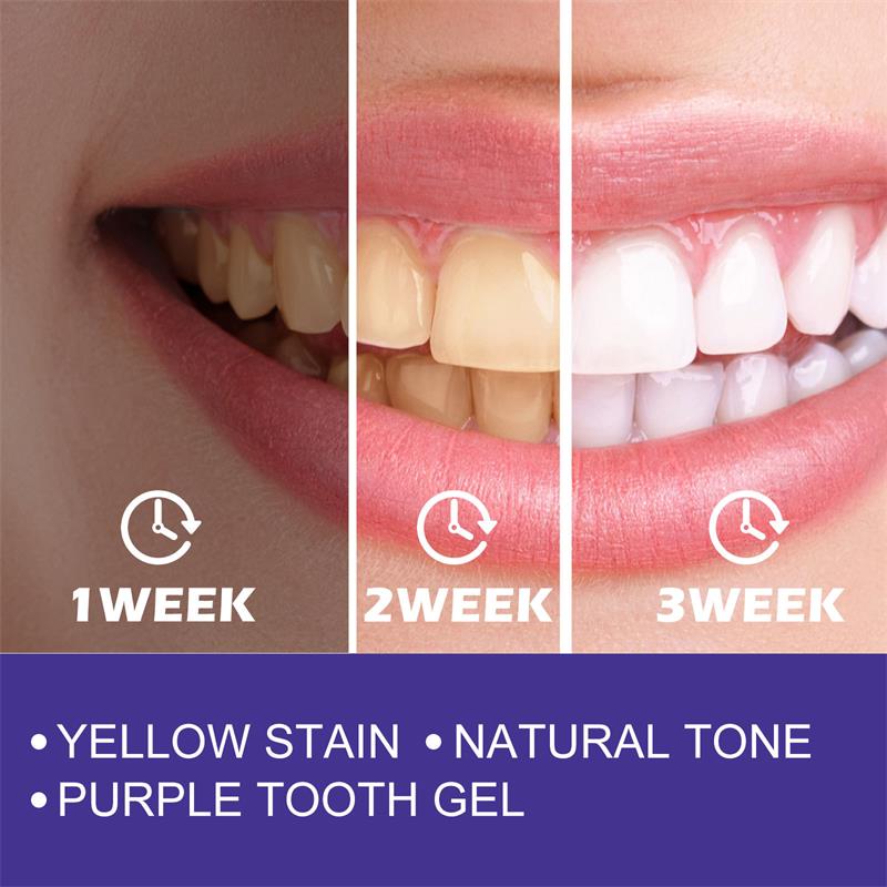 1ชิ้นยาสีฟันสูตรฟันขาวทำความสะ - Teeth Whitening In Korea บทวิจารณ์และราคา