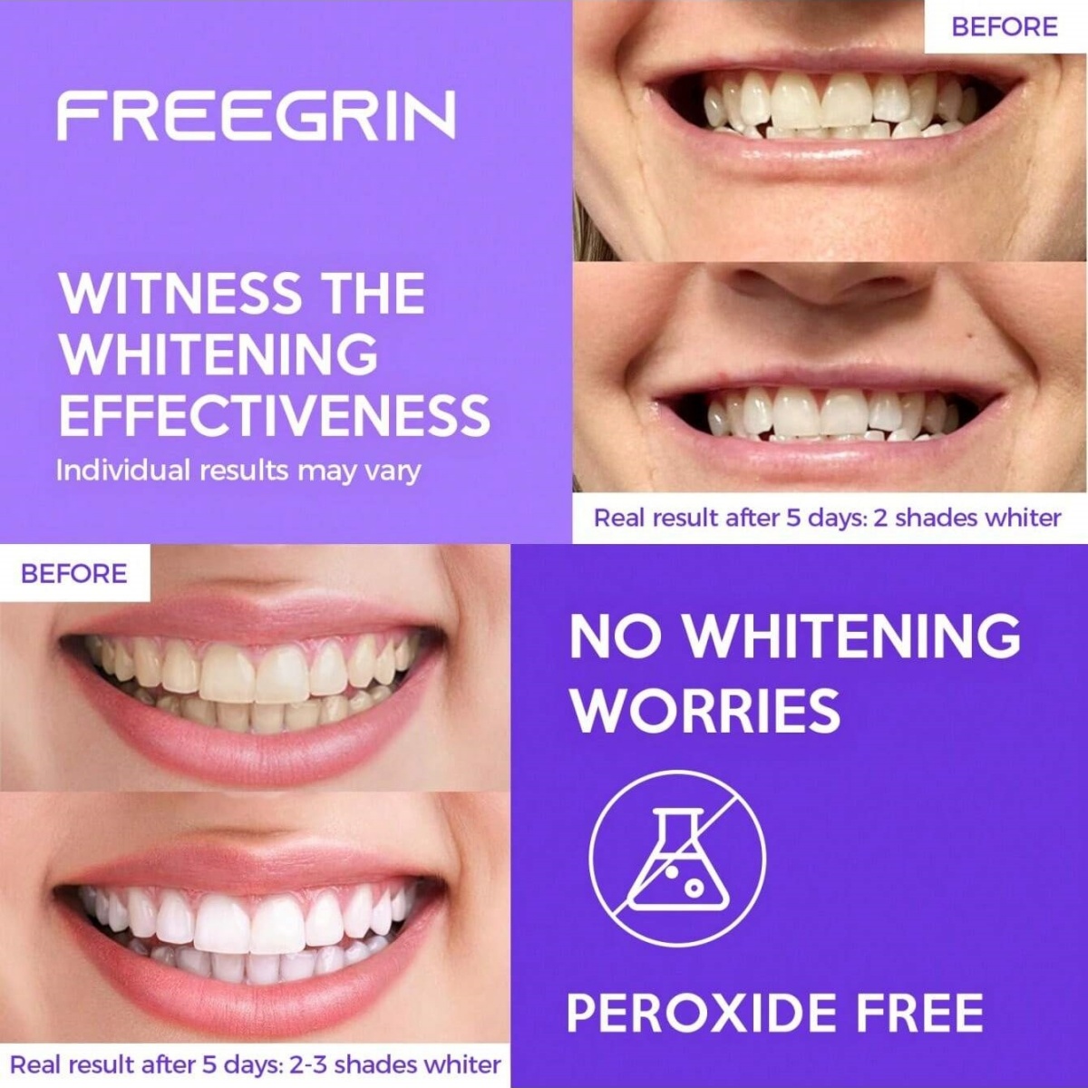 ดีลักซ์สติกเกอร์ฟอกสีฟัน 7/14/ - Teeth Whitening Q&M บทวิจารณ์และราคา