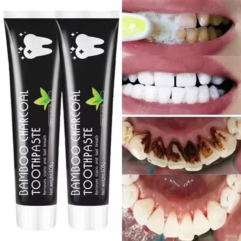 ยาสีฟันไวท์เทนนิ่ง ยาสีฟันถ่าน - Teeth Whitening Charcoal บทวิจารณ์และราคา